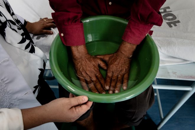Een man met lepra verzorgt zijn handen in een waterteiltje