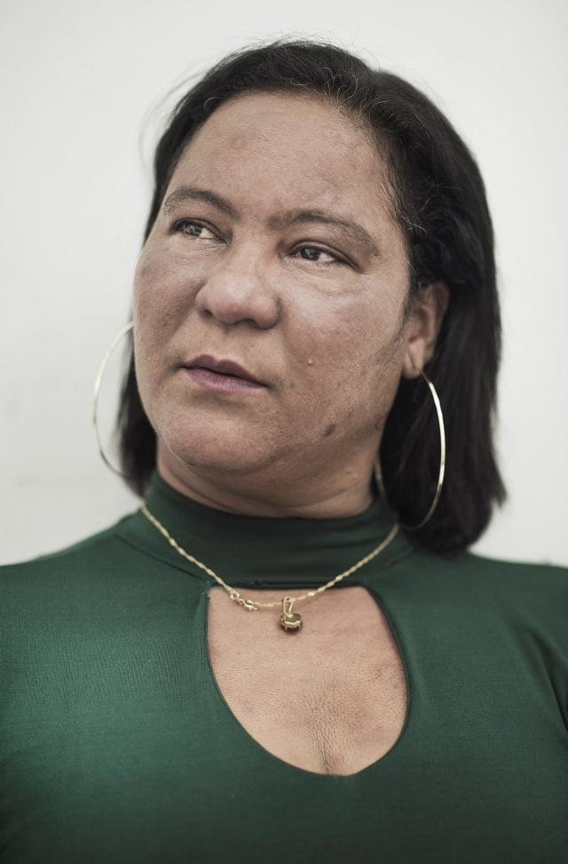 Josiane lijdt onder het stigma